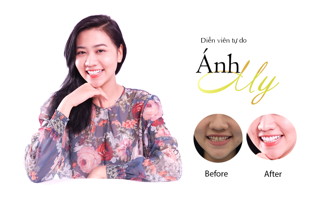 Diễn viên tự do Ánh My