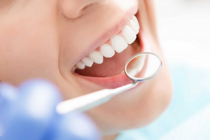 Bọc răng sứ đem đến một diện mạo hoàn toàn mới cho răng của bạn